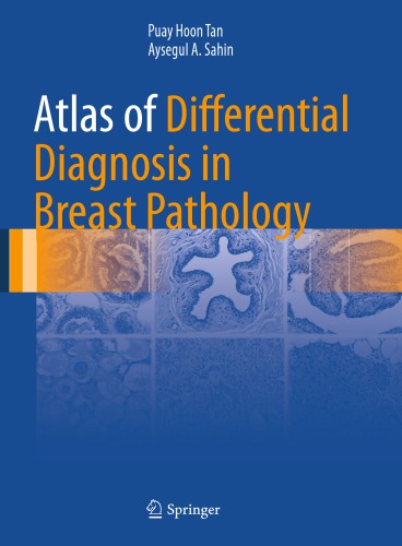 Atlas of differential diagnosis in breast pathology