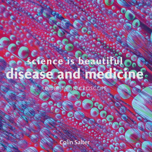 Science is beautiful: Disease and Medicine: Under the Microscope