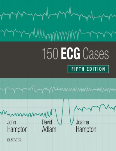 150 ECG Cases [CONVERTED PDF]