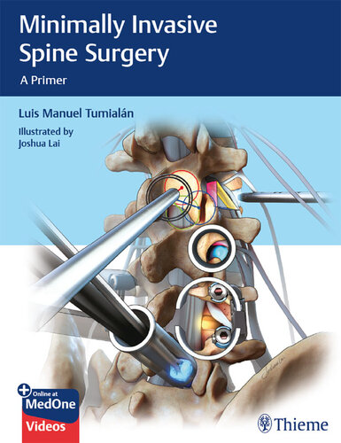 Minimally Invasive Spine Surgery: A Primer