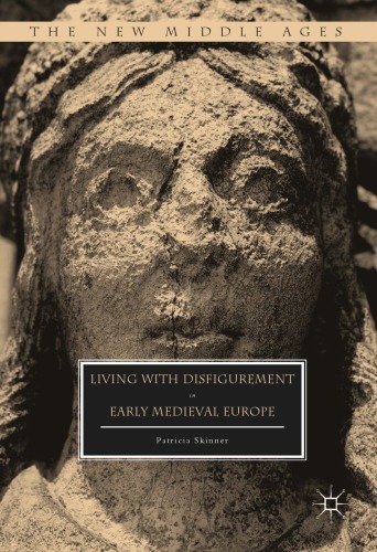 Living with disfigurement in early medieval Europe