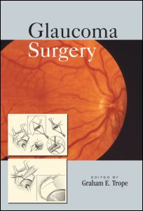 Glaucoma Surgery