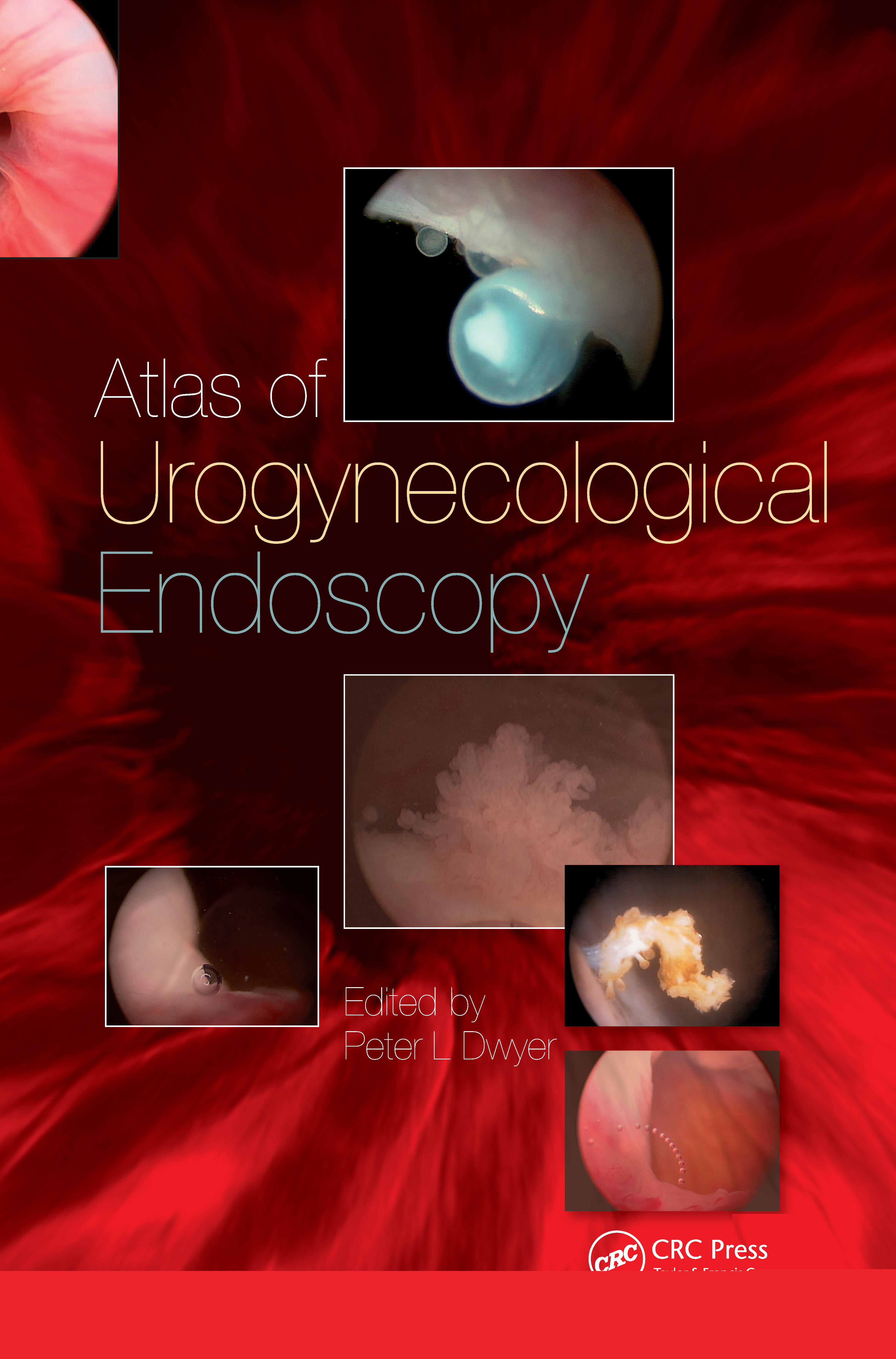 Handbook of Urologic Cryoablation