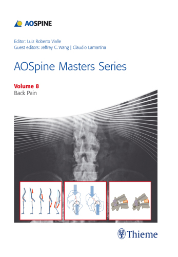 AOSpine Masters Series, Volume 8: Back Pain