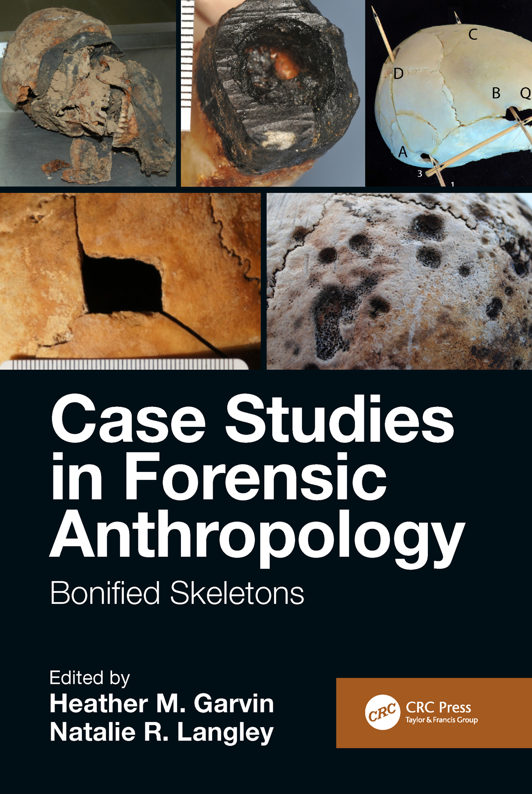 Case Studies in Forensic Anthropology: Bonified Skeletons