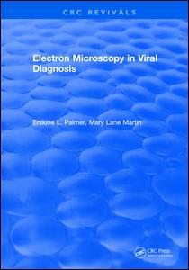 Electron Microscopy in Viral Diagnosis