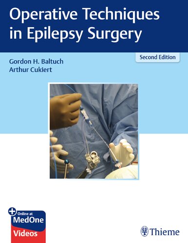 Operative techniques in epilepsy surgery