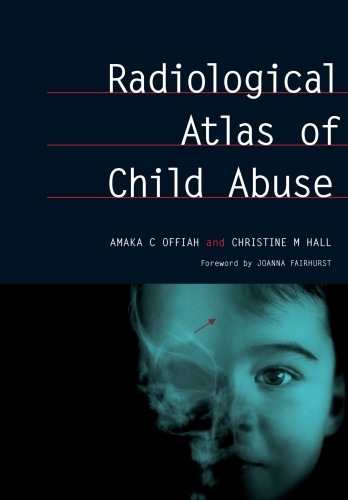 Radiological Atlas of Child Abuse: A Complete Resource for MCQs, v. 1
