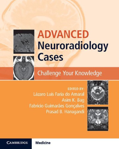 Advanced Neuroradiology Cases: Challenge Your Knowledge