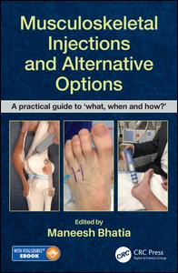 Musculoskeletal Injections and Alternative Options: A practical guide to 'what, when and how?'