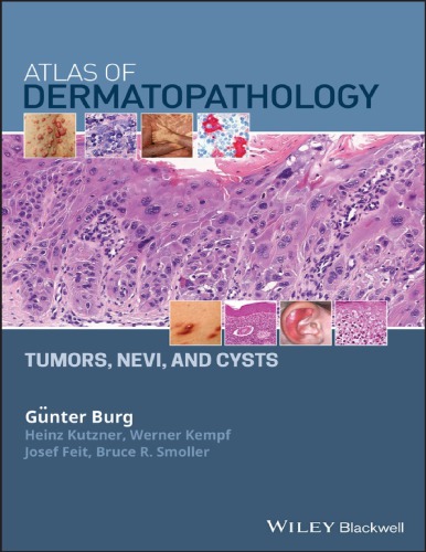 Atlas of dermatopathology tumors, nevi, and cysts