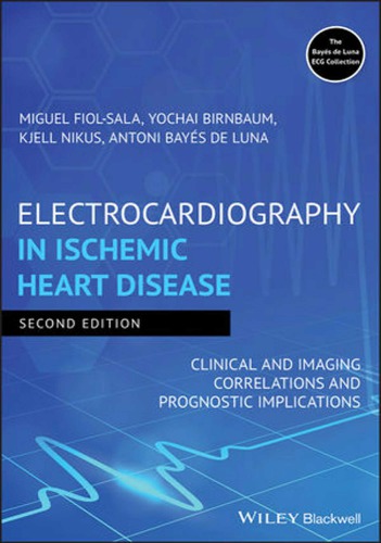 Electrocardiography in ischemic heart disease clinical and imaging correlations and prognostic implications