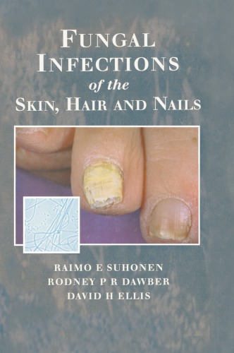 Fungal Infections Of The Skin And Nails