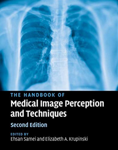 The handbook of medical image perception and techniques