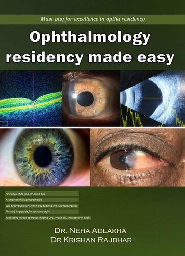 Ophthalmology residency made easy