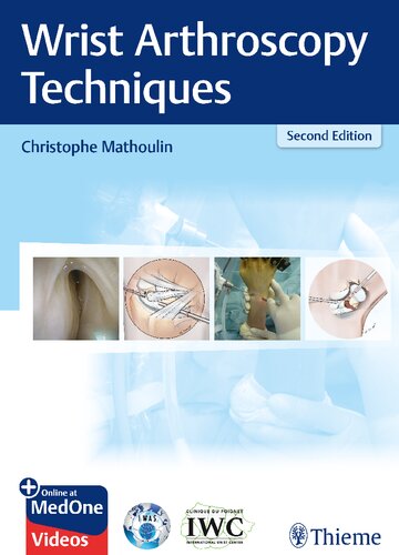 Wrist arthroscopy techniques