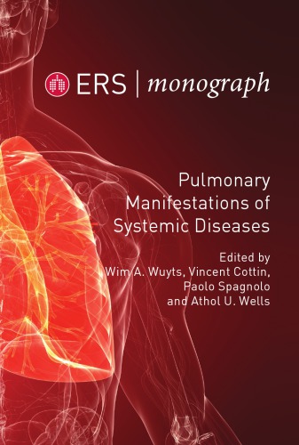 Pulmonary Manifestations of Systemic Diseases