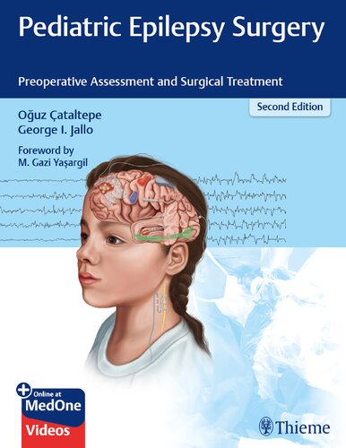 Pediatric Epilepsy Surgery: Preoperative Assessment and Surgical Treatment