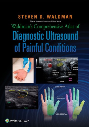Waldman’s Comprehensive Atlas of Diagnostic Ultrasound of Painful Conditions