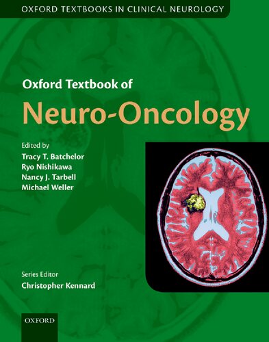 Oxford Textbook of Neuro-Oncology