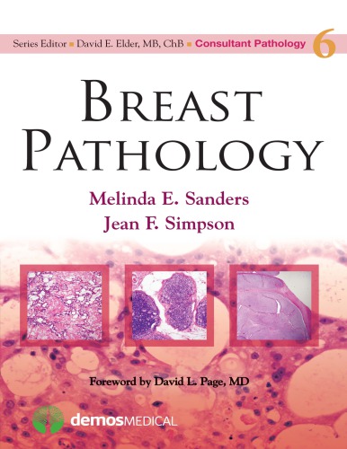 Breast Pathology ( Volume 6)
