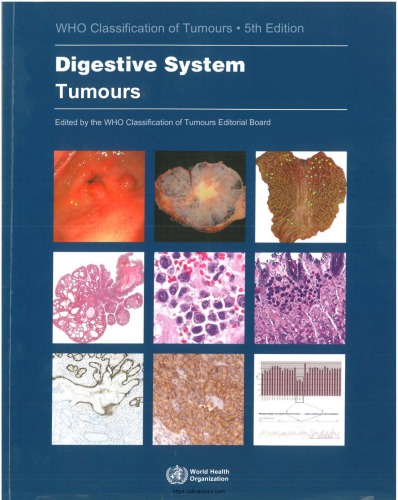 5th Edition Digestive System Tumours
