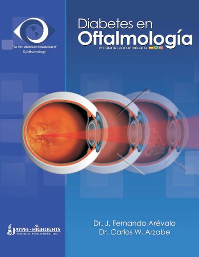 Diabetes en oftalmología: en idioma americano
