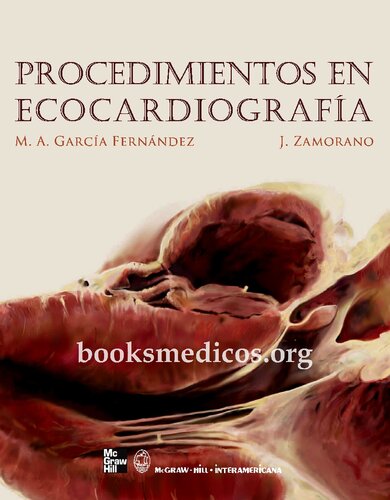 Procedimientos en ecocardiografia