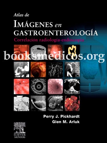 Atlas de imágenes en gastroenterología: correlación radiología-endoscopia