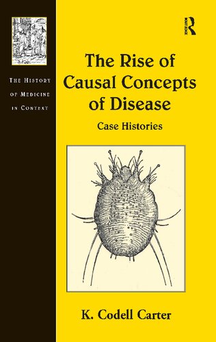 The Rise of Causal Concepts of Disease: Case Histories