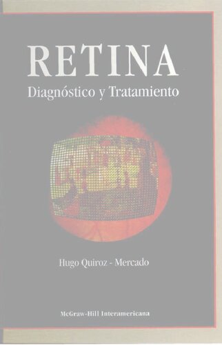 Retina: diagnÃ³stico y tratamiento