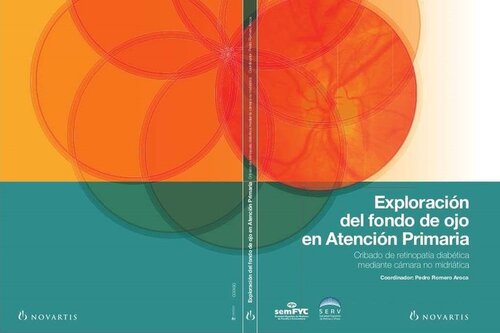 Exploración del Fondo de Ojo en Atención Primaria