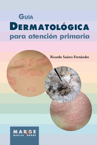 Guía Dermatológica para Atención Primaria
