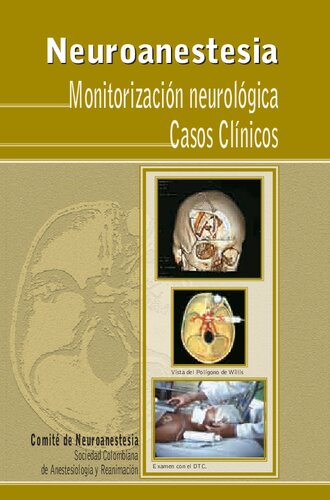 Neuroanestesia Casos Clinicos