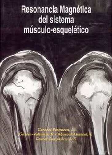 Resonancia magnetica del sistema musculoesqueletico