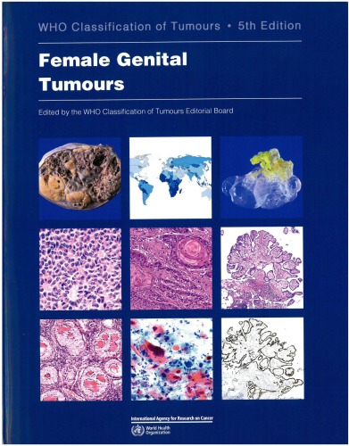 WHO Classification of Female Genital Tumours