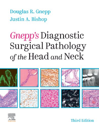 Gnepp's Diagnostic Surgical Pathology of the Head and Neck
