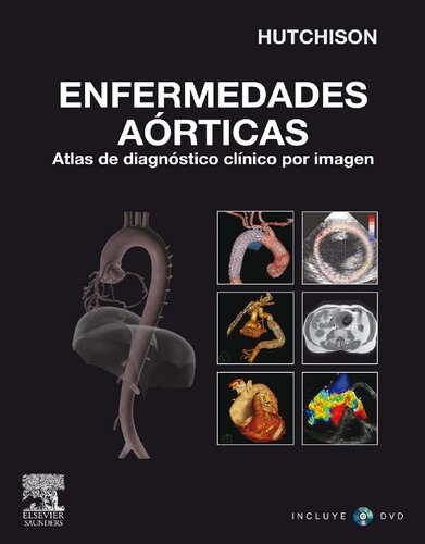 Enfermedades aórticas