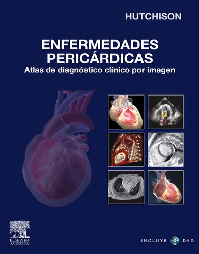 Enfermedades pericárdicas: Atlas de Diagnostico Clinico Por Imagen