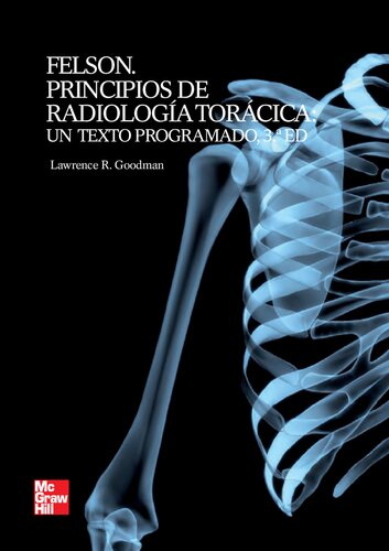 Felson. Principios de Radiología torácica