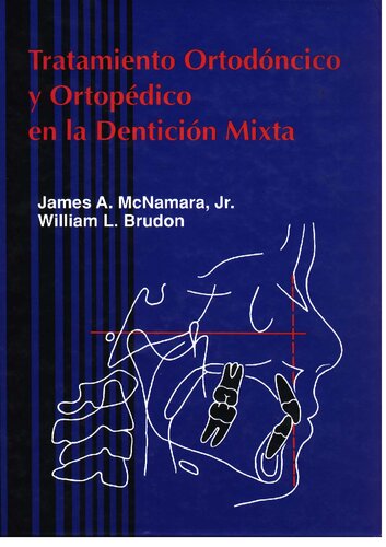 Tratamiento Ortodontico y Ortopedico en la Denticion Mixta
