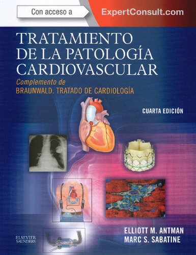 Tratamiento De La Patologia Cardiovascular Braunwald 4ed (opt)