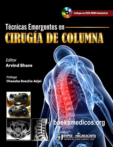 Tecnicas Emergentes En Cirugia De Columna