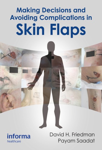 Making decisions and avoiding complications in skin flaps