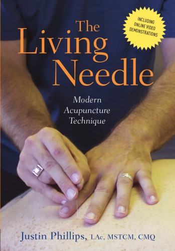 The living needle: modern acupuncture technique
