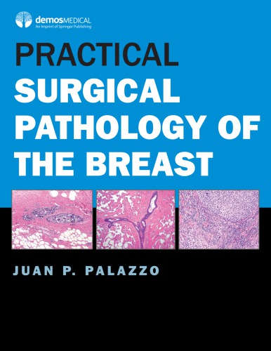 Practical surgical pathology of the breast