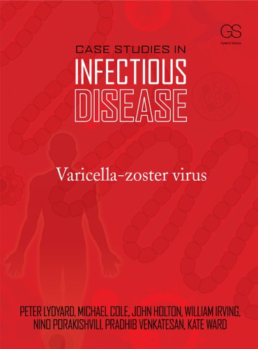 Case studies in infectious disease: Varicella-zoster virus