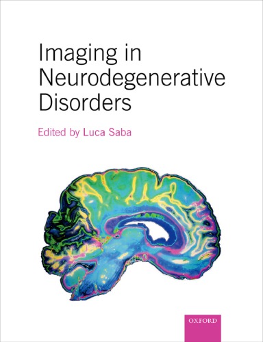 Imaging in neurodegenerative disorders