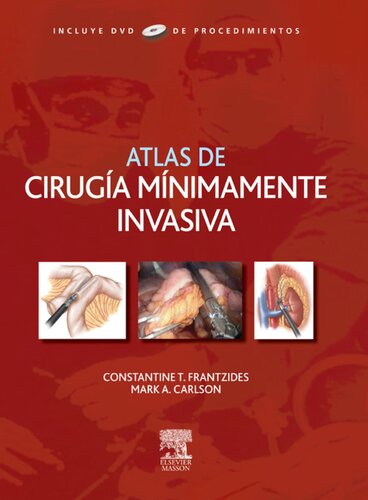 Atlas de cirugía mínimamente invasiva