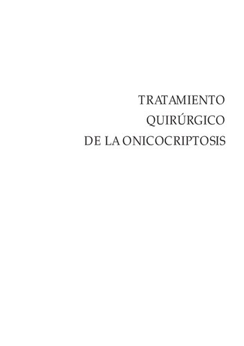 Tratamiento quirúrgico de la onicocriptosis
